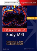fundamentals of body mri (fundamentals of radiology) 2nd edition