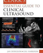 clark’s essential guide to clinical ultrasound (clark’s companion essential guides) 1st edition