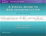 a visual guide to ecg interpretation second edition