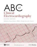 abc of clinical electrocardiography (abc series)
