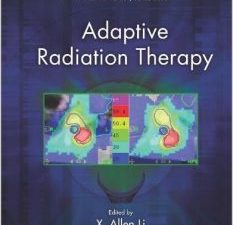 adaptive radiation therapy