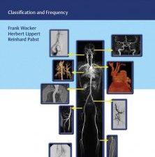 arterial variations in humans: key reference for radiologists and surgeons