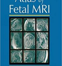 atlas of fetal mri 1st edition