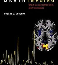 brain imaging: what it can (and cannot) tell us about consciousness