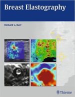 breast elastography