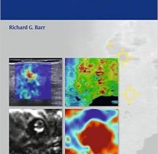 breast elastography