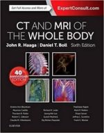 ct and mri of the whole body, 2 volume set 6th edition