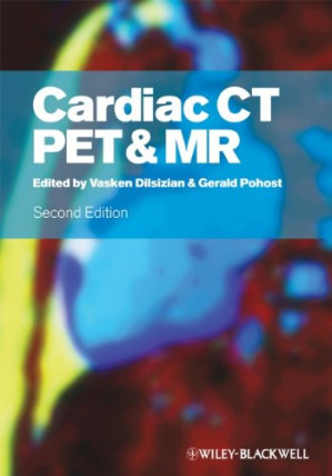 cardiac ct, pet and mr – 2nd edition