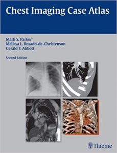 chest imaging case atlas edition 2
