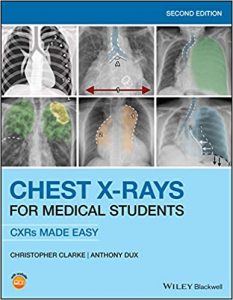 chest x rays for medical students: cxrs made easy 2nd edition
