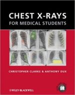 chest x rays for medical students 1st edition