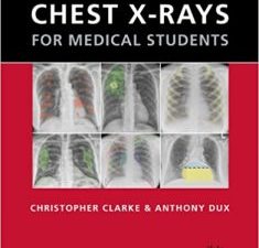 chest x rays for medical students 1st edition