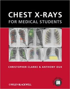 chest x rays for medical students 1st edition