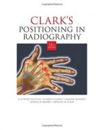 clark’s positioning in radiography
