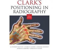 clark’s positioning in radiography