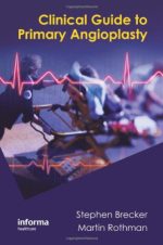clinical guide to primary angioplasty