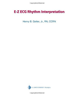 e z ecg rhythm interpretation