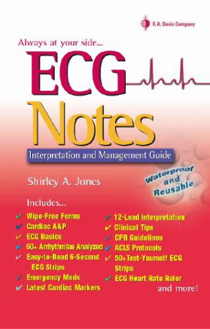ecg notes: interpretation and management guide