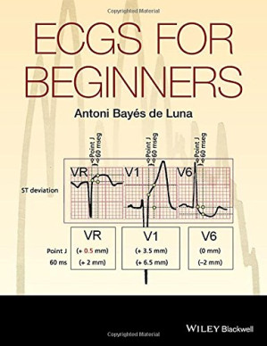 ecgs for beginners (2014 release)