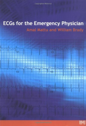 ecg’s for the emergency physician 1