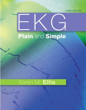 ekg plain and simple (3rd edition)