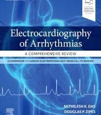 electrocardiography of arrhythmias: a comprehensive review: a companion to cardiac electrophysiology: expert consult