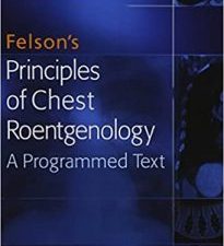 felson’s principles of chest roentgenology text (goodman, felson’s principles of chest roentgenology) – 3rd edition