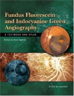 fundus fluorescein and indocyanine green angiography: a textbook and atlas