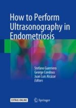 how to perform ultrasonography in endometriosis