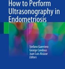 how to perform ultrasonography in endometriosis