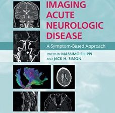 imaging acute neurologic disease: a symptom based approach