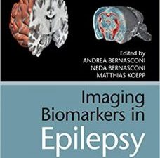 imaging biomarkers in epilepsy