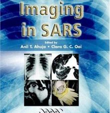imaging in sars
