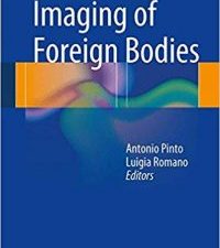 imaging of foreign bodies