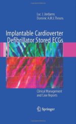 implantable cardioverter defibrillator stored ecgs: clinical management and case reports