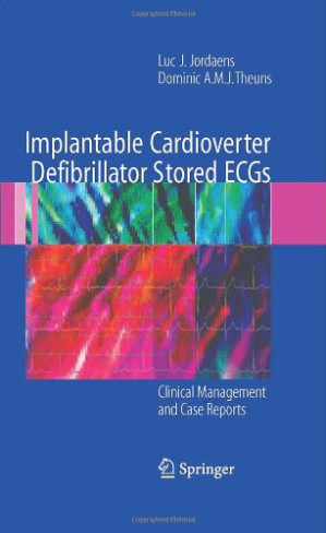 implantable cardioverter defibrillator stored ecgs: clinical management and case reports