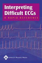 interpreting difficult ecgs