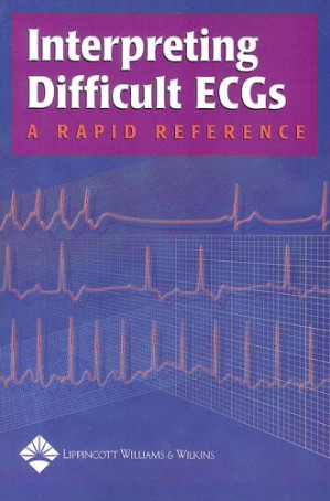 interpreting difficult ecgs: a rapid reference