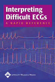 interpreting difficult ecgs
