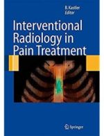 interventional radiology in pain treatment