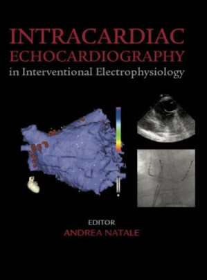 intracardiac echocardiography in interventional electrophysiology: advanced management of atrial fibrillation and ventricular tachycardia