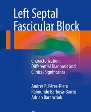 left septal fascicular block