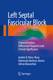 left septal fascicular block