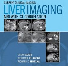 liver imaging: mri with ct correlation