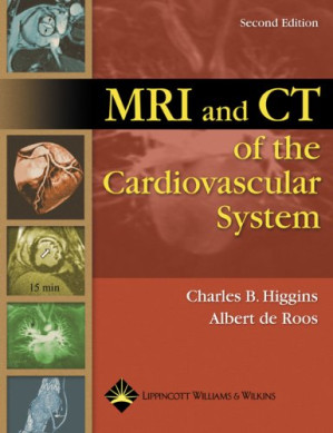 mri and ct of the cardiovascular system (2nd edition)