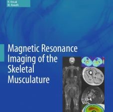 magnetic resonance imaging of the skeletal musculature