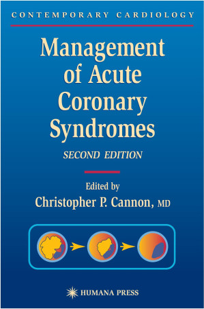 management of acute coronary syndromes