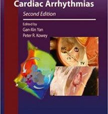 management of cardiac arrhythmias (contemporary cardiology) 2nd edition