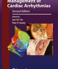 management of cardiac arrhythmias (contemporary cardiology) – 2nd edition