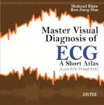 master visual diagnosis of ecg: a short atlas (learn ecg through ecg)